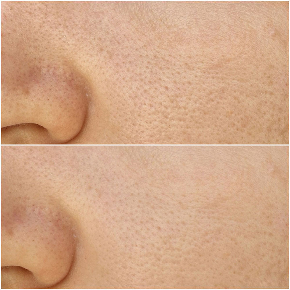 کرم ضد جوش سر سیاه و کنترل منافذ منیو manyo Blackhead & Pore Cream — تصویر ۶
