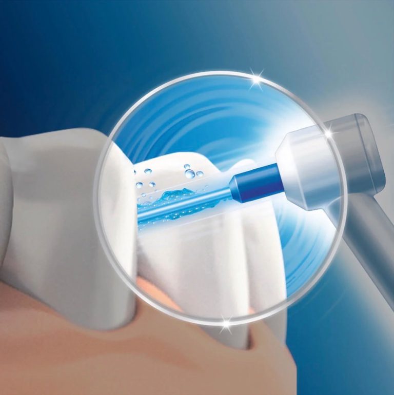 واترجت دندان اورال بی مدل Waterjet (Idropulsore) — تصویر ۴