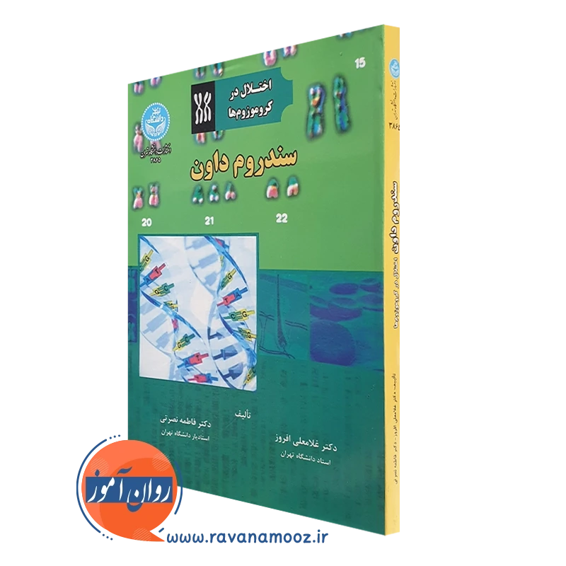 سندروم داون (اختلال در کروموزوم ها) – غلامعلی افروز