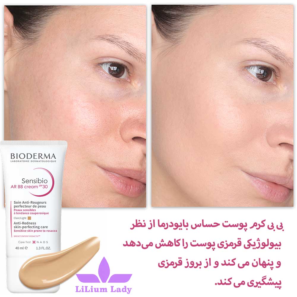 بی بی کرم پوست حساس بایودرما رنگ روشن — تصویر ۴