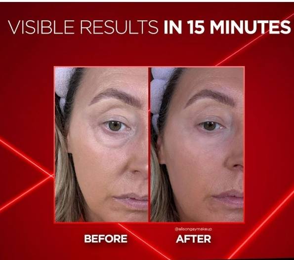 سرم رفع پف دور چشم لورآل Revitalift Laser Eye Bag Instant Eraser — تصویر ۵