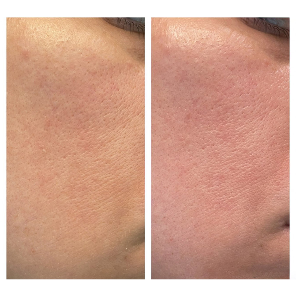 کیت ضد لک و روشن کننده یوجا نیاسین سام بای می SOME BY MI Yuja Niacin Anti Blemish Starter Kit — تصویر ۶