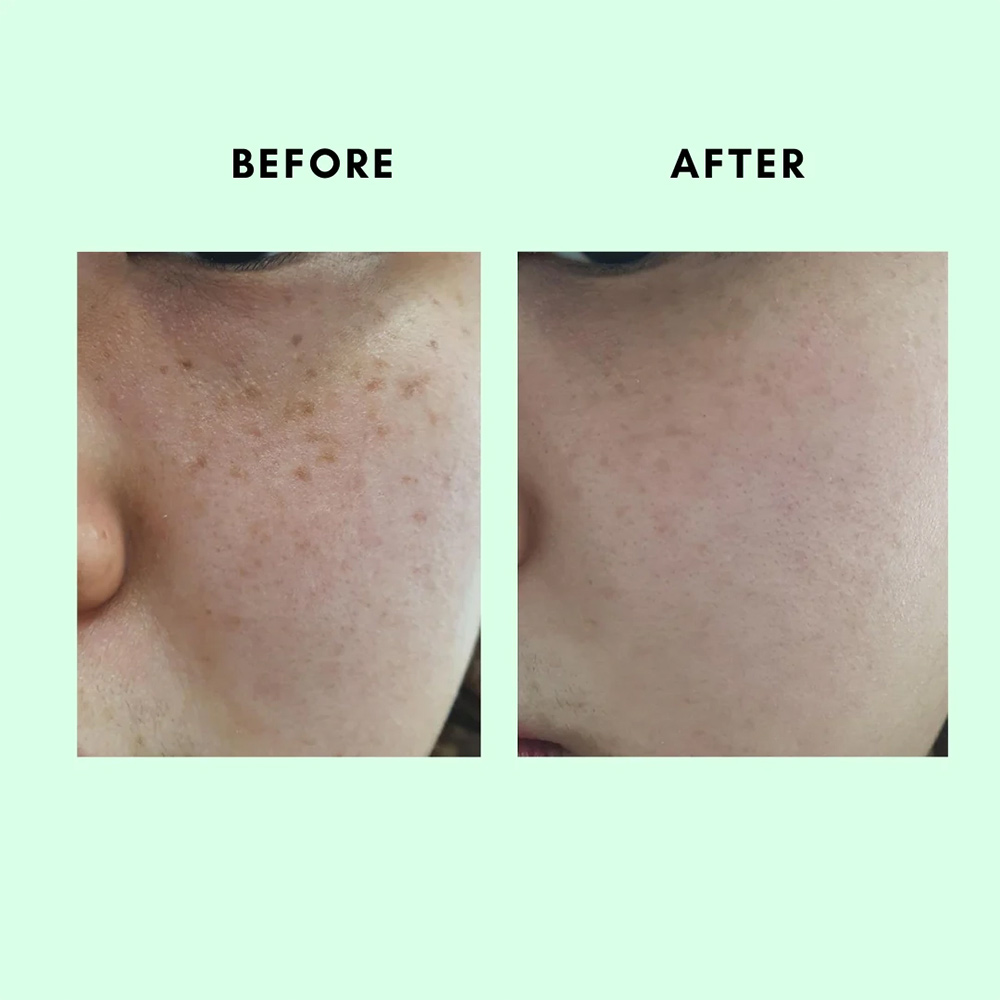 کیت ضد لک و روشن کننده یوجا نیاسین سام بای می SOME BY MI Yuja Niacin Anti Blemish Starter Kit — تصویر ۸