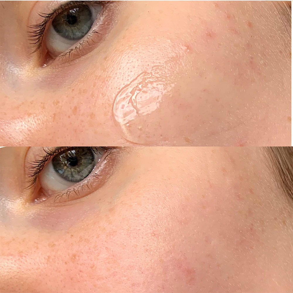 کیت ضد لک و روشن کننده یوجا نیاسین سام بای می SOME BY MI Yuja Niacin Anti Blemish Starter Kit — تصویر ۵