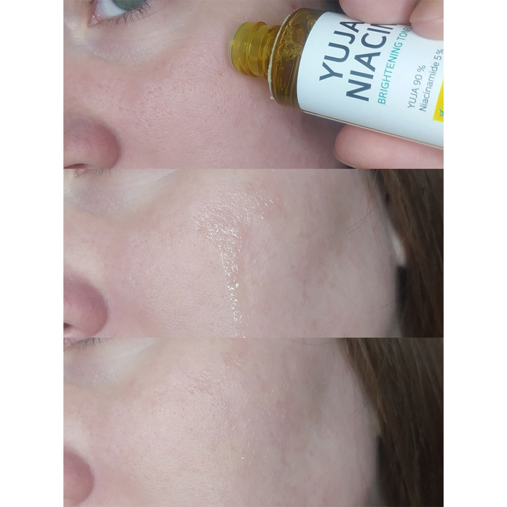 کیت ضد لک و روشن کننده یوجا نیاسین سام بای می SOME BY MI Yuja Niacin Anti Blemish Starter Kit — تصویر ۷