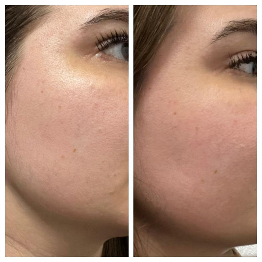 کیت ضد لک و روشن کننده یوجا نیاسین سام بای می SOME BY MI Yuja Niacin Anti Blemish Starter Kit — تصویر ۴