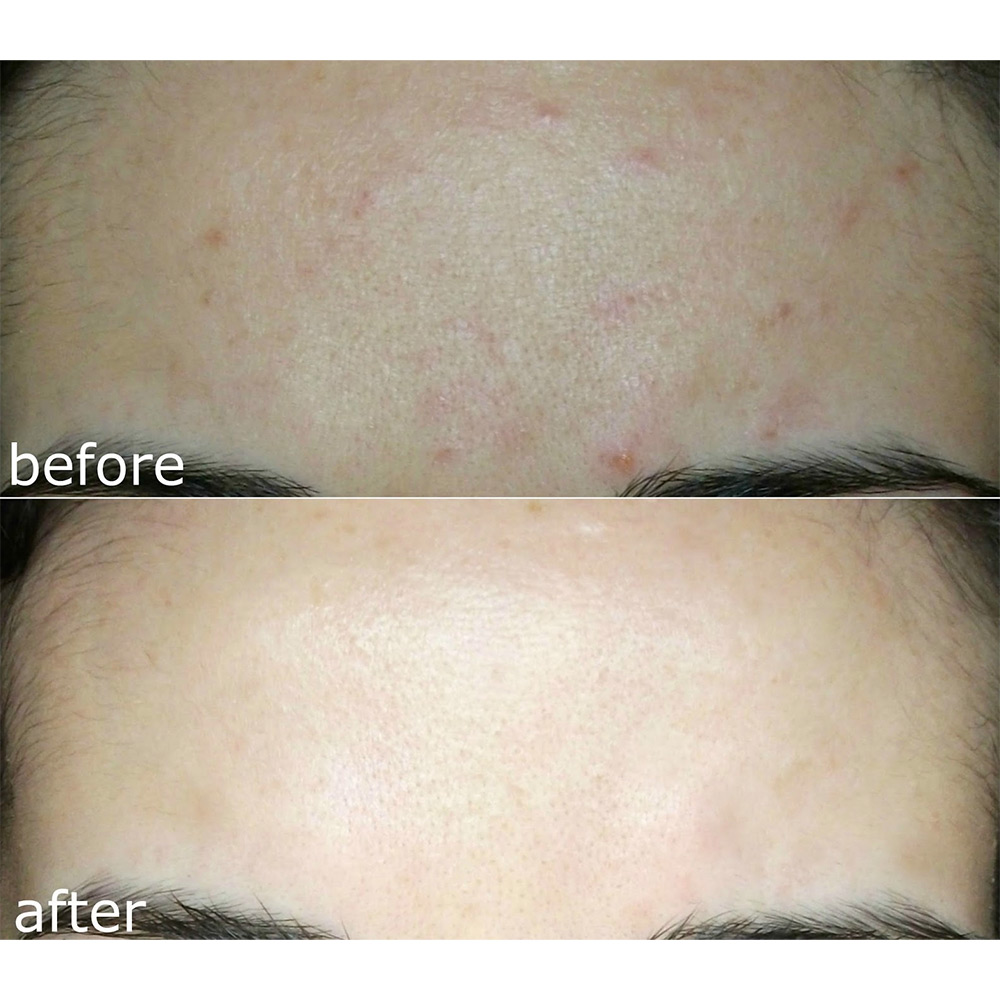 سرم آبرسان موسین حلزون و هیالورونیک اسید کاز دی باها Cos De BAHA SH Snail Mucin Hyaluronic Acid Serum 120ml — تصویر ۶