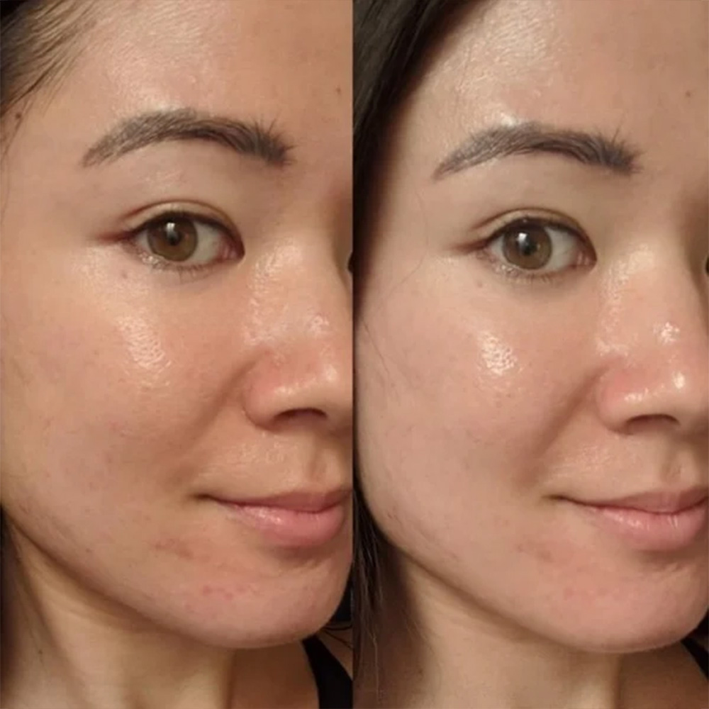 سرم ضدلک آربوتین نیاسینامید کاز دی باها Cos De BAHA AN Arbutin Niacinamide Serum 30ml — تصویر ۶