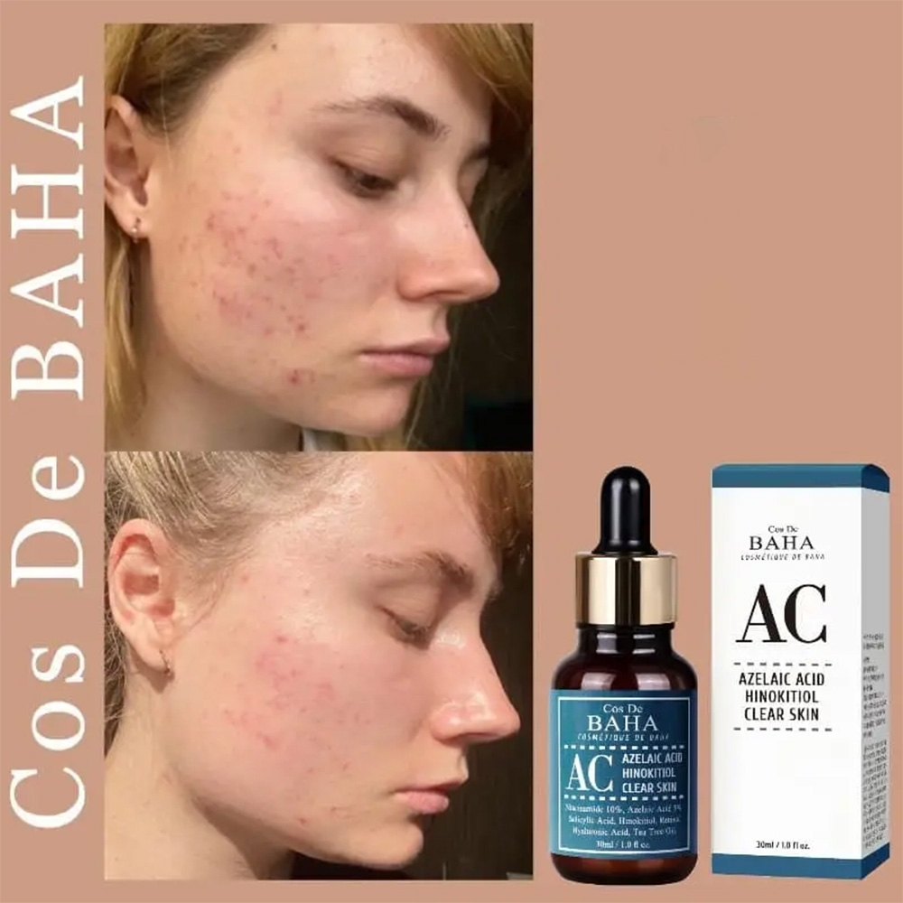 سرم ضد جوش همه کاره آزلائیک اسید کاز دی باها Cos De BAHA Azelaic Acid Hinokitiol Clear Skin Serum 30ml — تصویر ۶