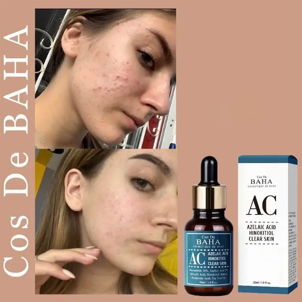 سرم ضد جوش همه کاره آزلائیک اسید کاز دی باها Cos De BAHA Azelaic Acid Hinokitiol Clear Skin Serum 30ml — تصویر ۸