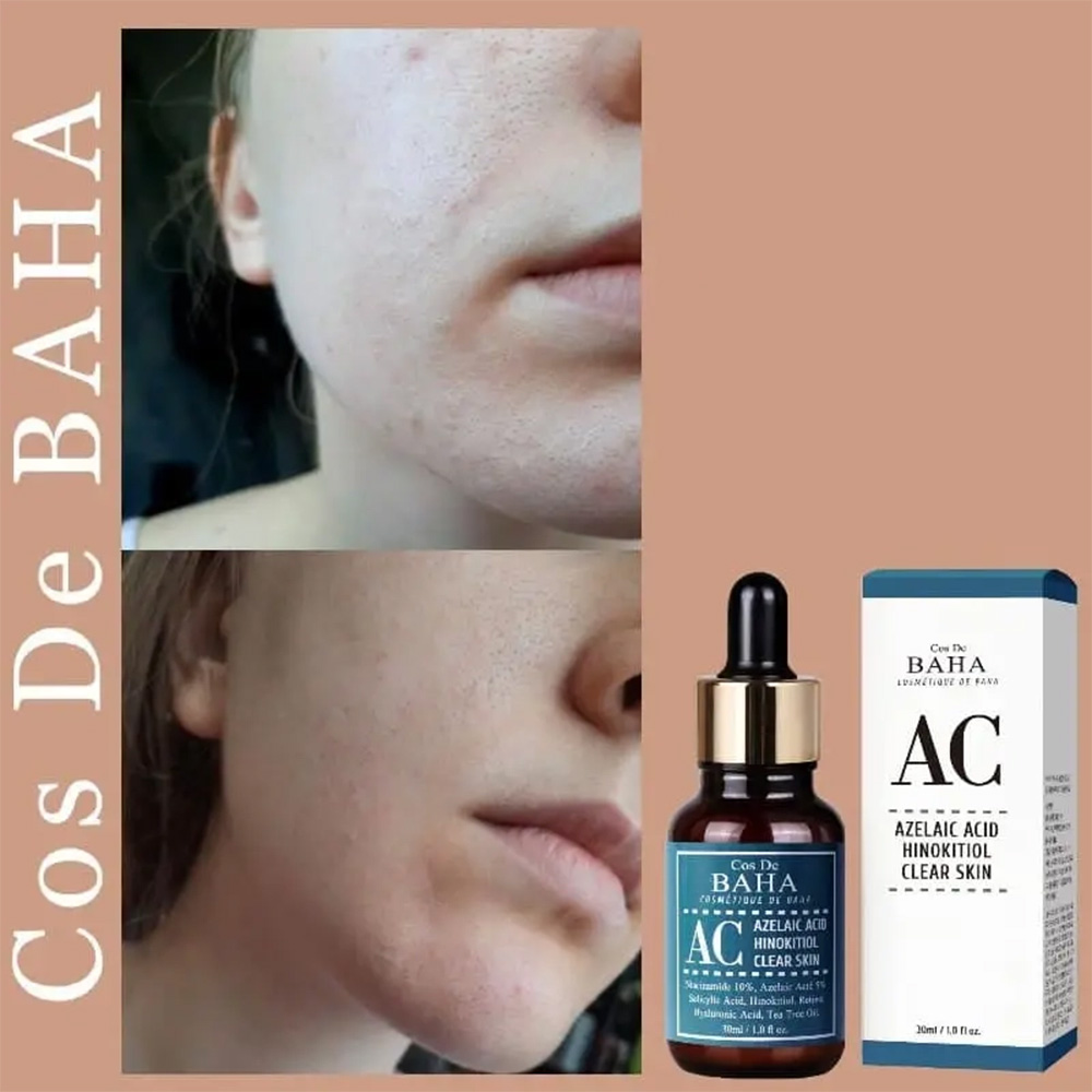 سرم ضد جوش همه کاره آزلائیک اسید کاز دی باها Cos De BAHA Azelaic Acid Hinokitiol Clear Skin Serum 30ml — تصویر ۷