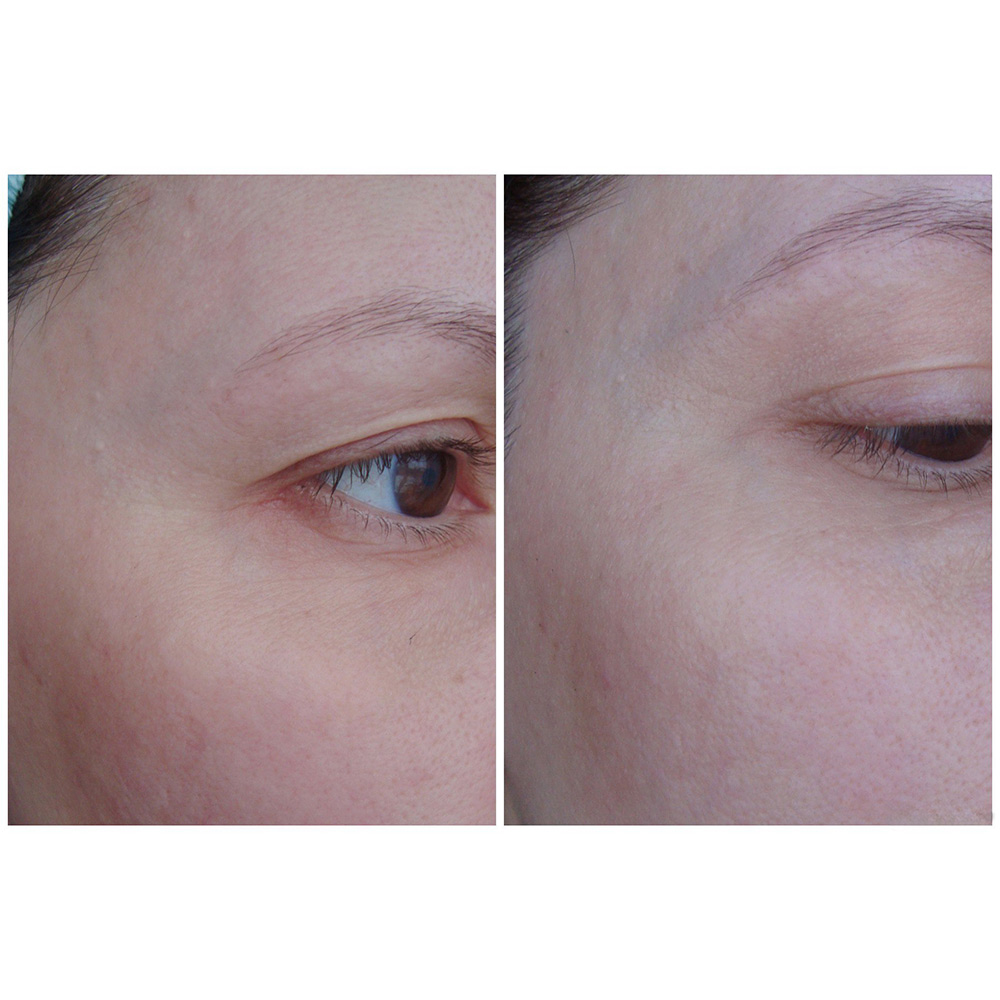 کرم دور چشم و صورت روشن کننده و ضد پیری AHC Ten Revolution Real Eye Cream For Face — تصویر ۸