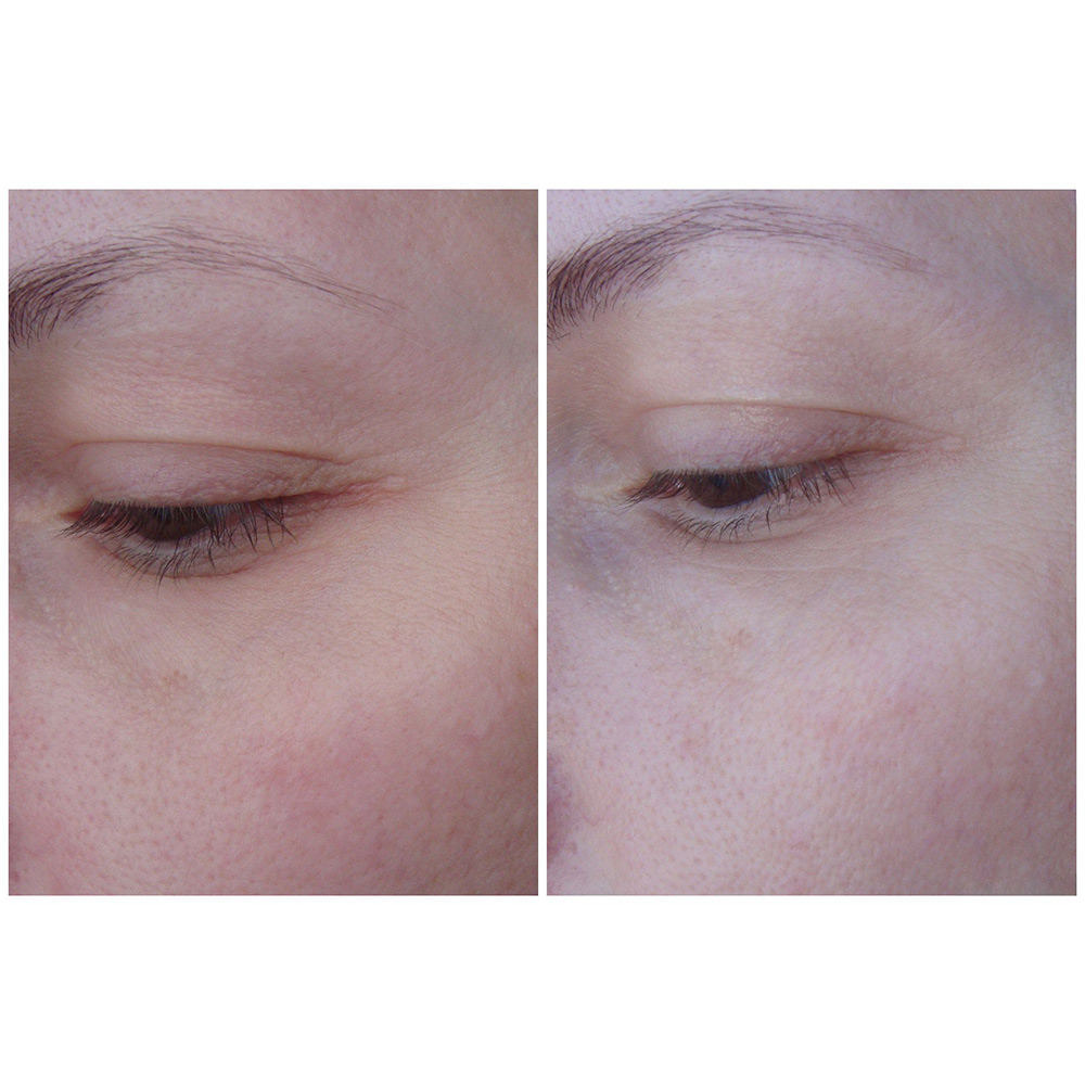 کرم دور چشم و صورت روشن کننده و ضد پیری AHC Ten Revolution Real Eye Cream For Face — تصویر ۷