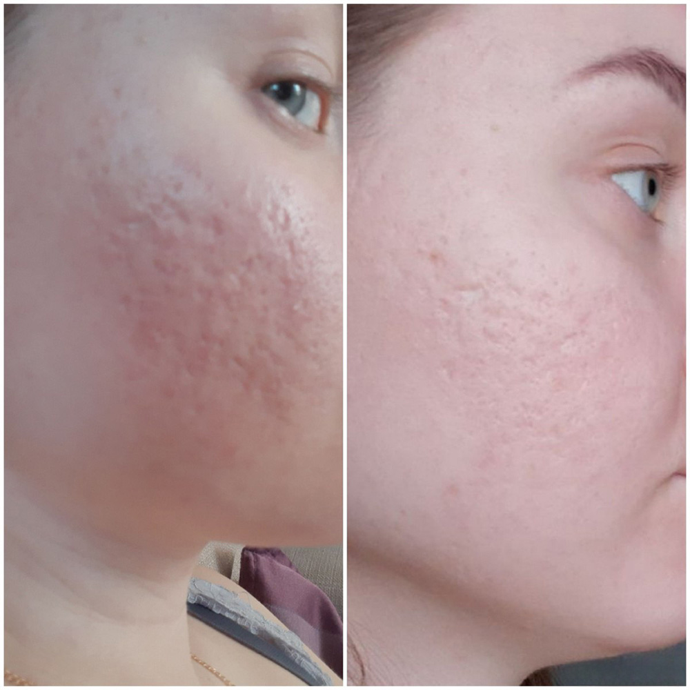 سرم حلزون سیاه ترمیم کننده و تسکین دهنده پوست سام بای می اسنیل تروسیکا Some By Mi Snail Truecica Miracle Repair Serum — تصویر ۷