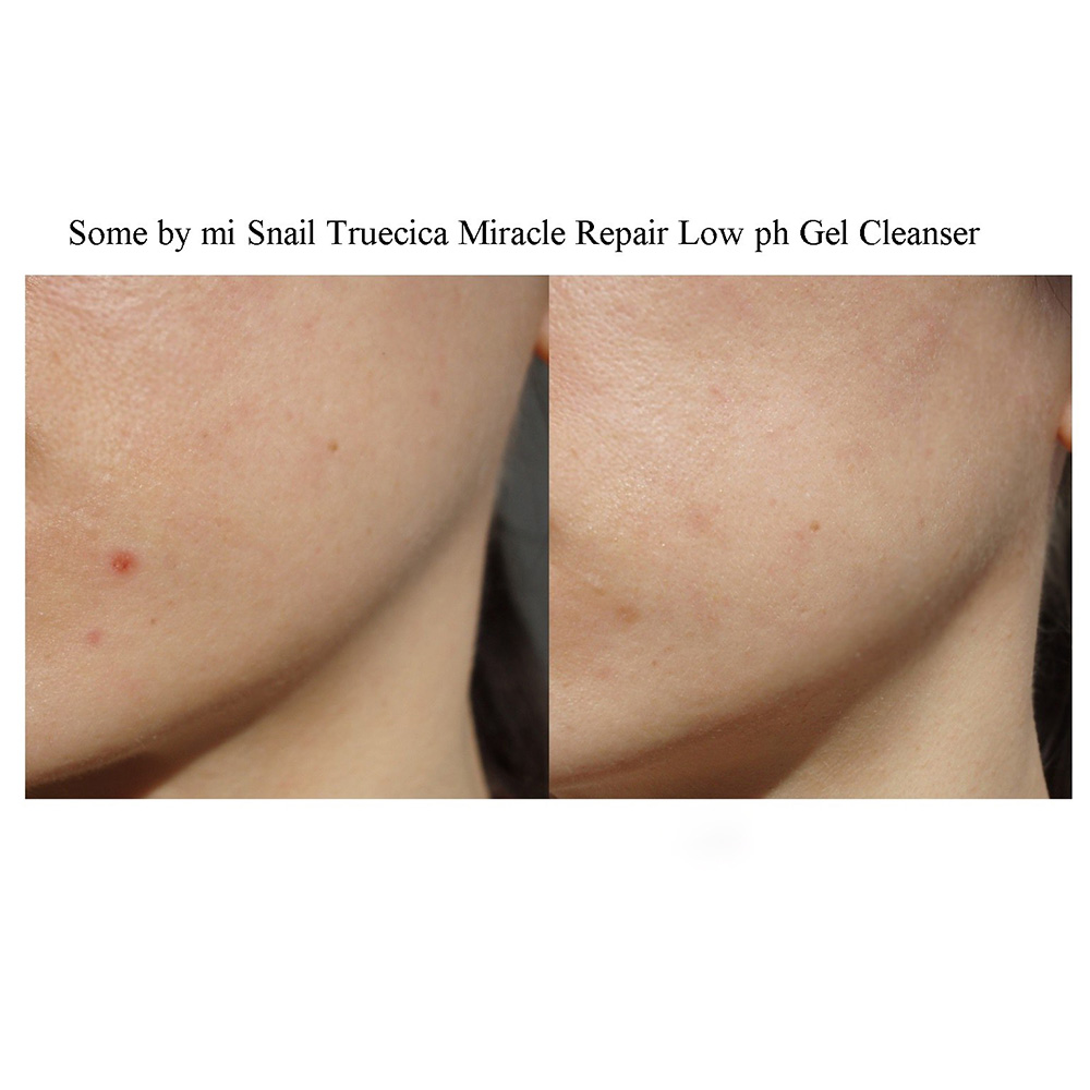 سرم حلزون سیاه ترمیم کننده و تسکین دهنده پوست سام بای می اسنیل تروسیکا Some By Mi Snail Truecica Miracle Repair Serum — تصویر ۶