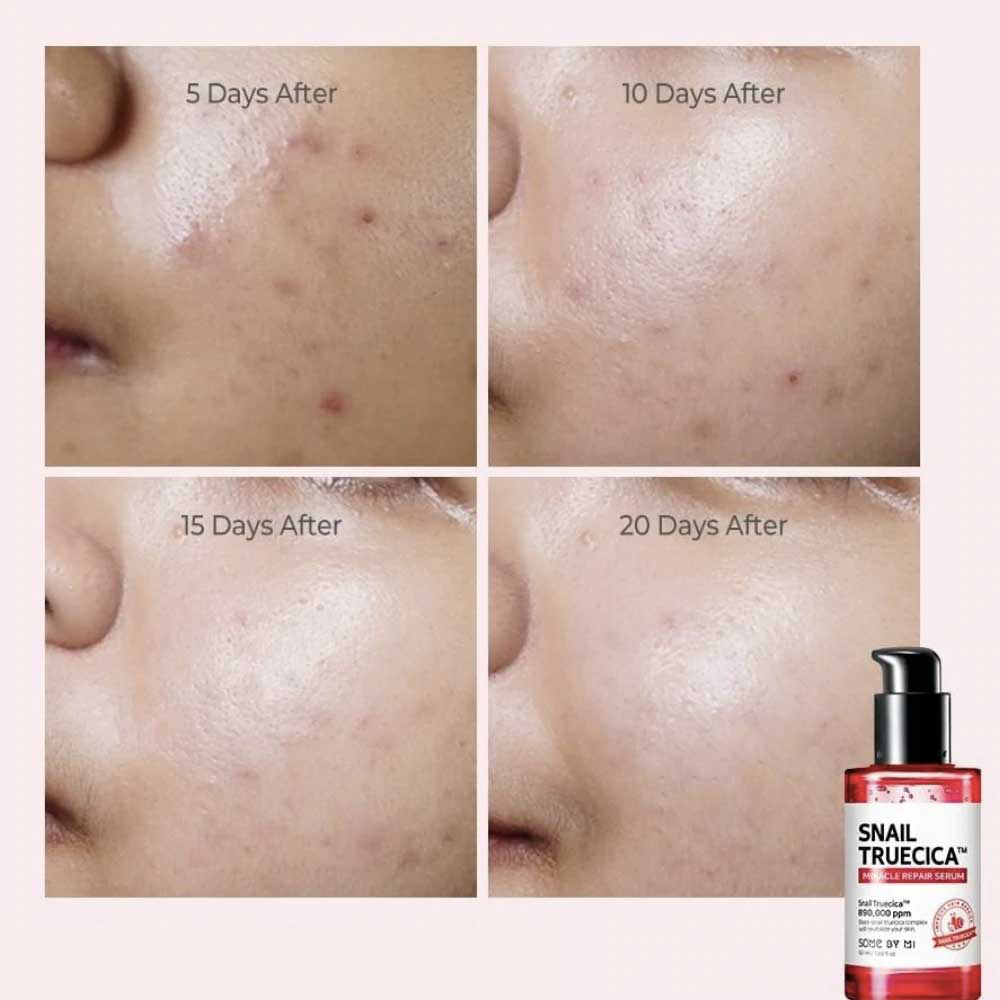 سرم حلزون سیاه ترمیم کننده و تسکین دهنده پوست سام بای می اسنیل تروسیکا Some By Mi Snail Truecica Miracle Repair Serum — تصویر ۴