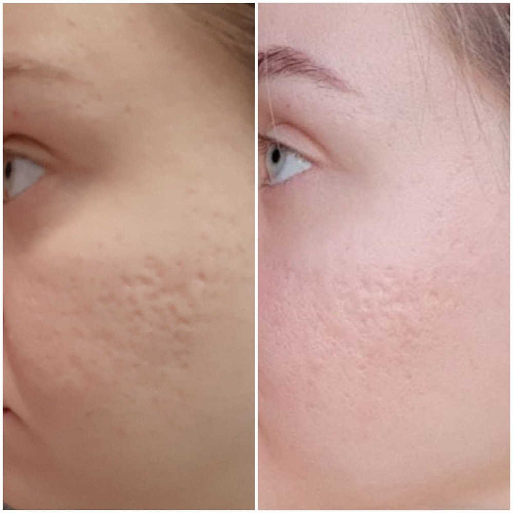 سرم حلزون سیاه ترمیم کننده و تسکین دهنده پوست سام بای می اسنیل تروسیکا Some By Mi Snail Truecica Miracle Repair Serum — تصویر ۸