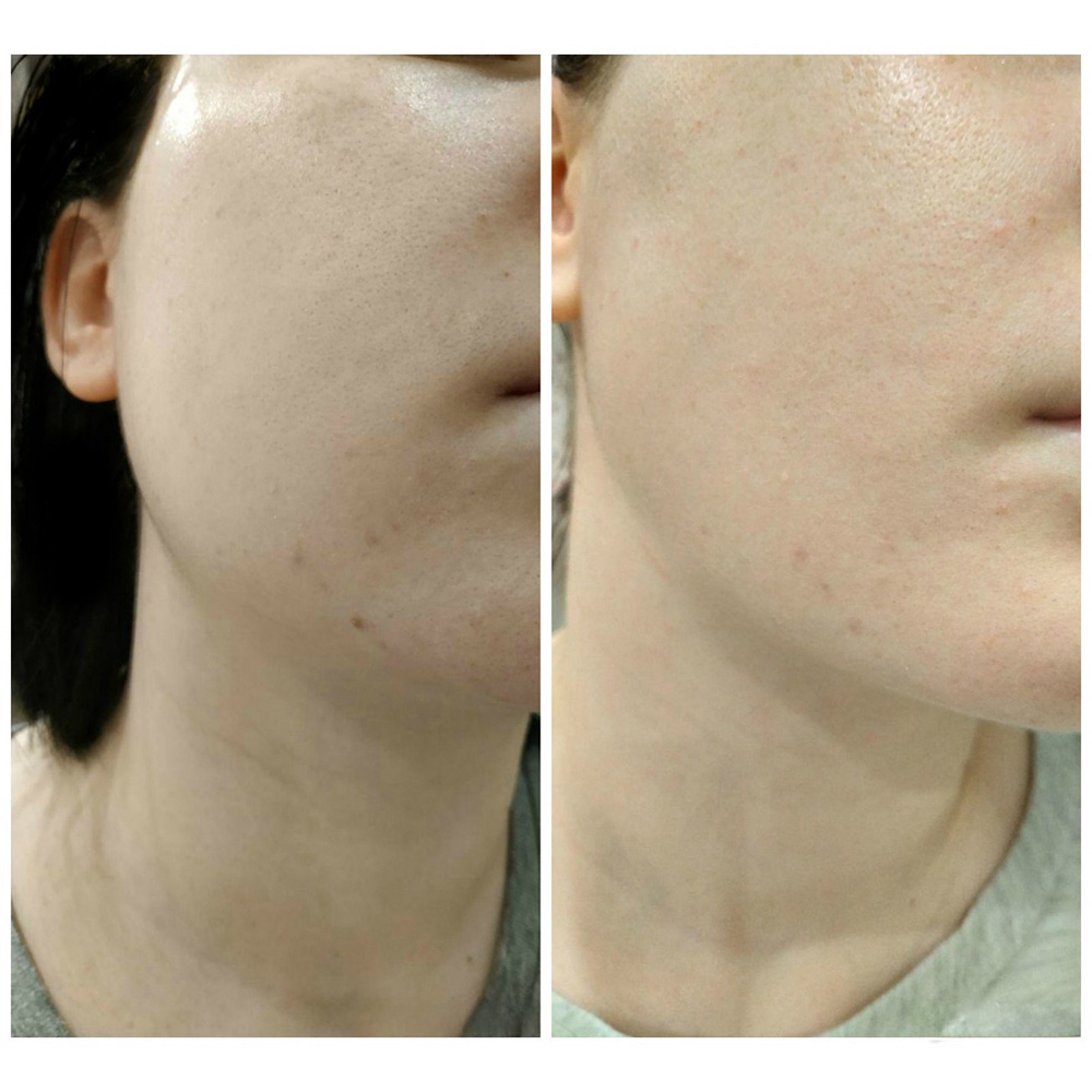 سرم حلزون سیاه ترمیم کننده و تسکین دهنده پوست سام بای می اسنیل تروسیکا Some By Mi Snail Truecica Miracle Repair Serum — تصویر ۵