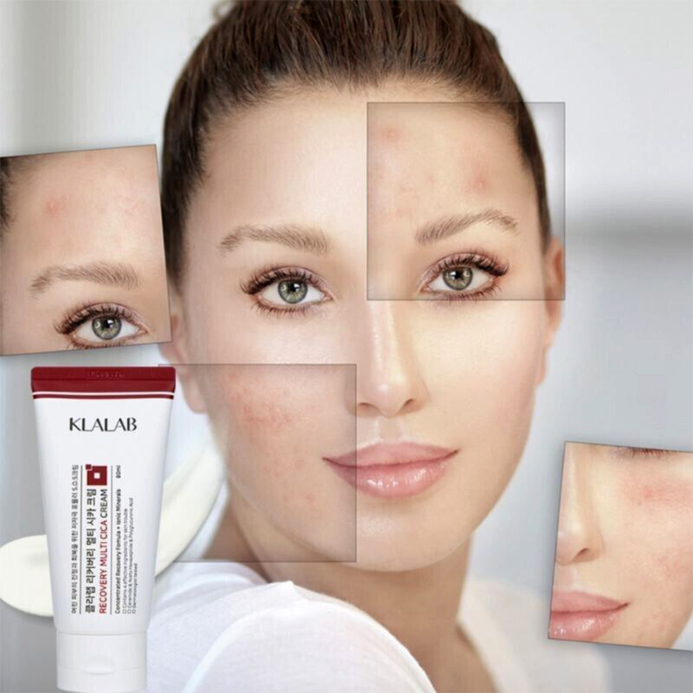 کرم مرطوب‌ کننده و ترمیم‌ کننده سد دفاعی پوست سوپر سیکا برند کلالب KLALAB Recovery Multi CICA Cream 80ml — تصویر ۲